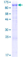 12.5% SDS-PAGE Stained with Coomassie Blue.